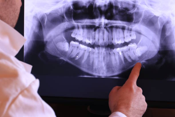 Best Emergency Treatment for Jaw Pain or Injury in Lorado Springs, CO